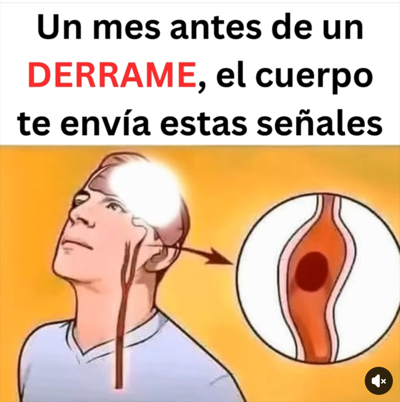 Le pasaba de todo, nadie sabía por qué y los médicos le encontraron un gusano vivo en el cerebro