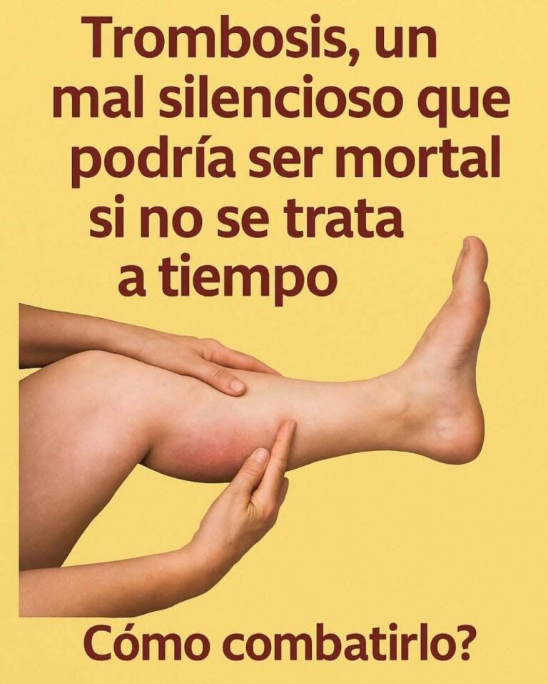 Trombosis, un mal silencioso que podría ser mortal si no se trata a tiempo