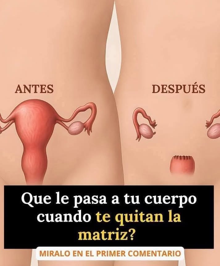 ¿Qué le pasa a tu cuerpo cuando te quitan la matriz?