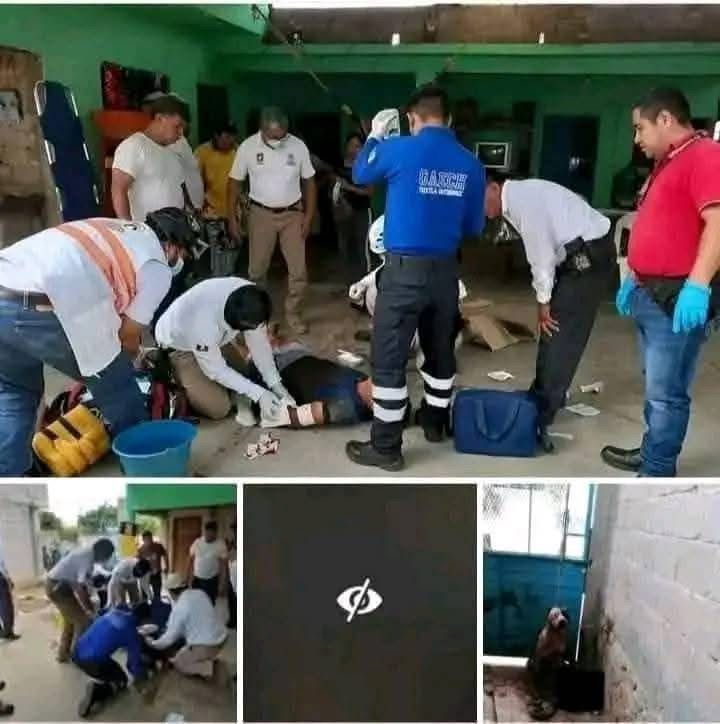 Pitbull ataca a un supuesto ladrón y casi le arranca un brazo — Video viral