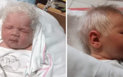 👶 Niño nace con el pelo blanco – cuando el médico cuenta la verdad la mamá queda impactada img