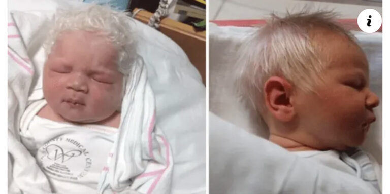 👶 Niño nace con el pelo blanco – cuando el médico cuenta la verdad la mamá queda impactada