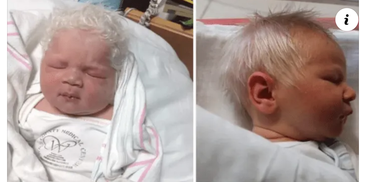 👶 Niño nace con el pelo blanco – cuando el médico cuenta la verdad la mamá queda impactada