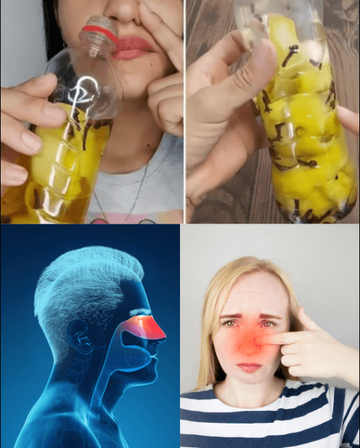 Un remedio natural para rinitis, sinusitis y mareos que podría cambiar tu vida