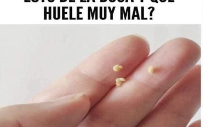 Mi boca huele muy mal: causas y soluciones img