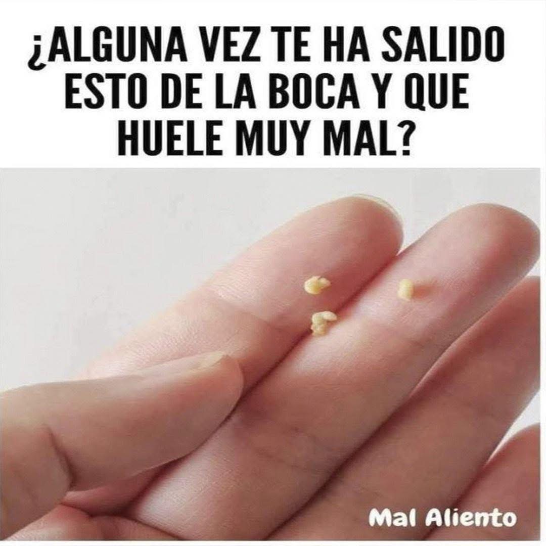 Mi boca huele muy mal: causas y soluciones