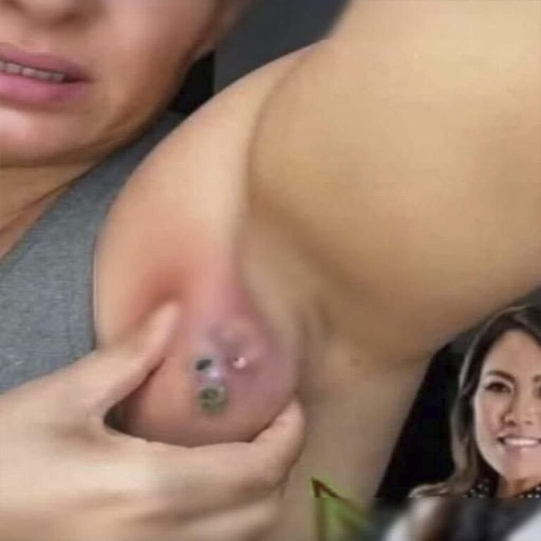 ⚠️ Si te sale un bulto en la axila… NO lo ignores 😳 esto podría ser lo que tu cuerpo intenta decirte