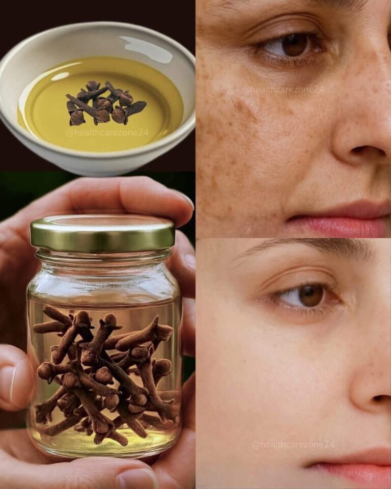 La mascarilla casera de clavo y miel que está sorprendiendo por sus efectos en la piel