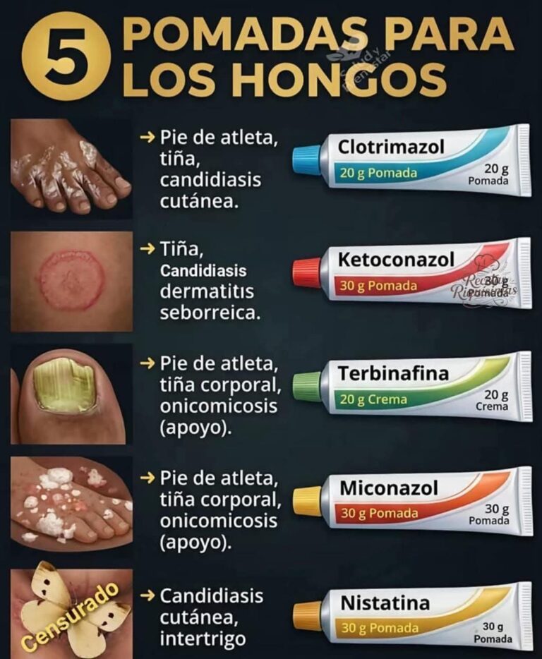 Las 5 pomadas más usadas contra los hongos que están dando resultados (y lo que debes saber antes de usarlas)