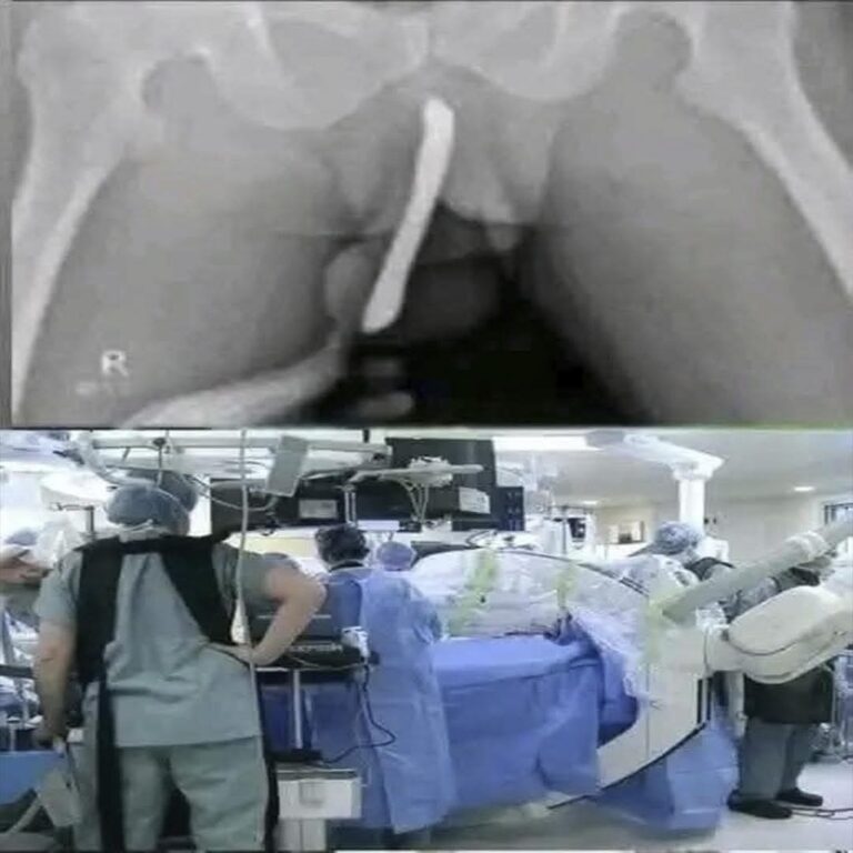 Nadie lo esperaba… una molestia leve terminó en urgencia médica y dejó una fuerte advertencia