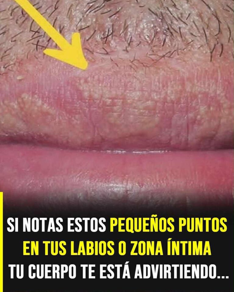 Granos de Fordyce: qué son, por qué aparecen y cuándo debes preocuparte