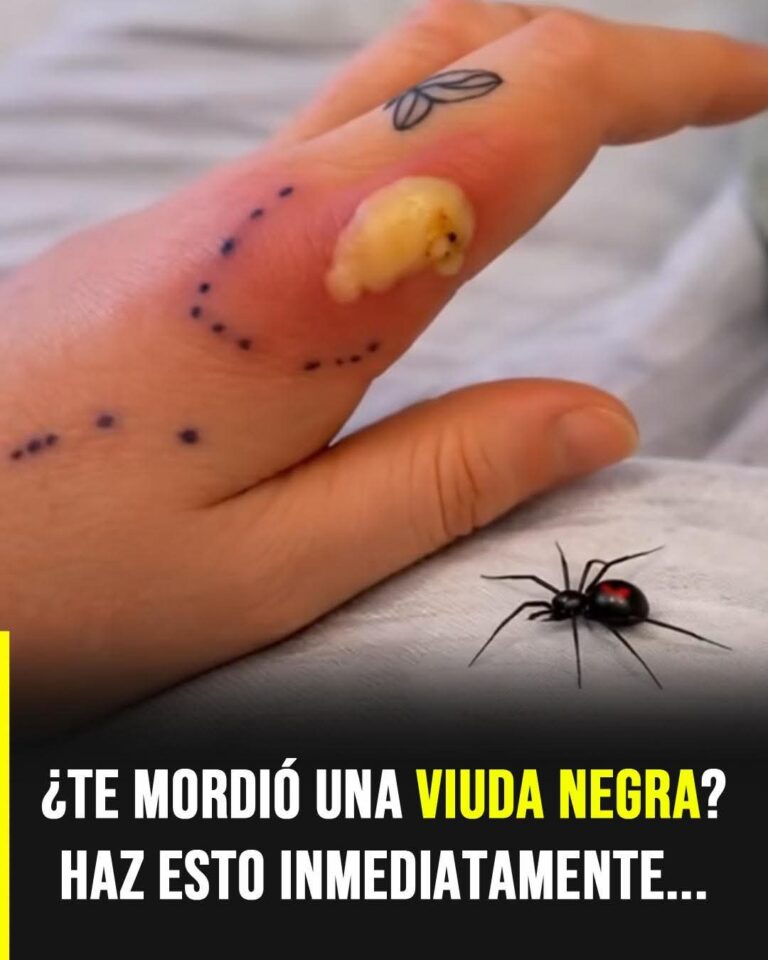 ¿Te mordió una viuda negra? Lo que debes hacer de inmediato (y lo que nadie te dice)