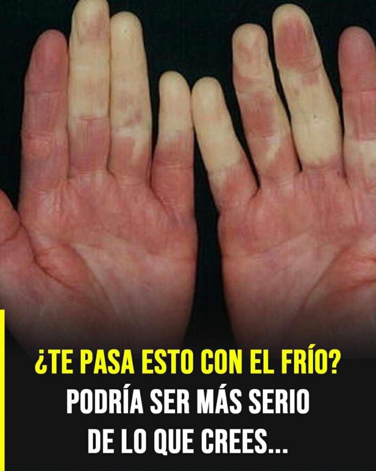 ¿Tus dedos cambian de color con el frío? Podría ser una señal silenciosa que no debes ignorar