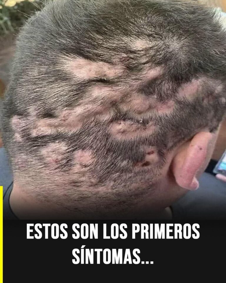 Estos son los primeros síntomas en el cuero cabelludo que podrían alertarte sobre algo más serio