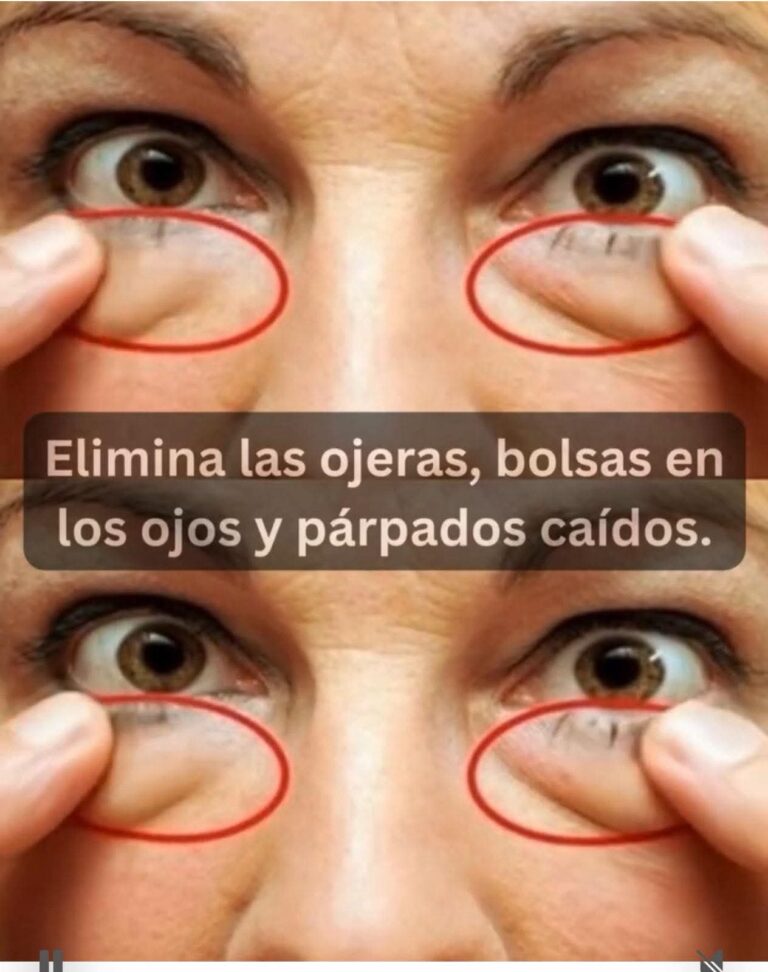 El truco casero para eliminar las ojeras que muchos están probando (y lo que debes saber antes)