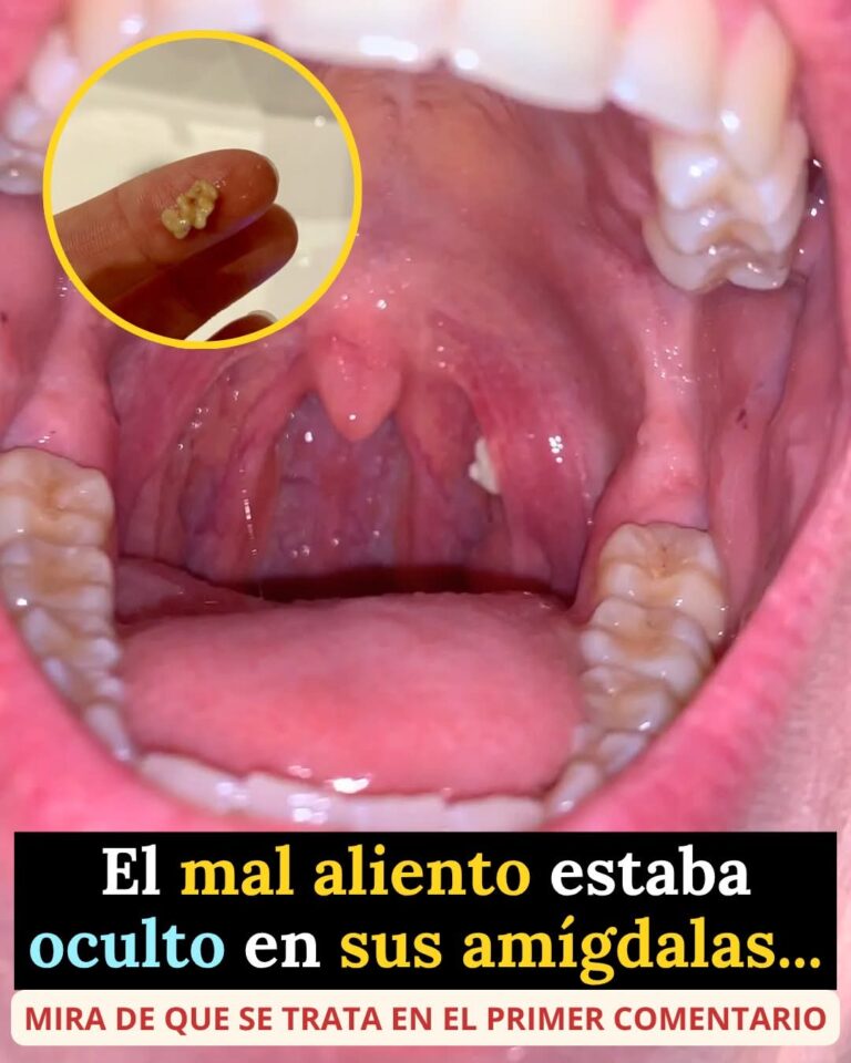 Si tienes mal aliento… puede que la causa esté oculta en tus amígdalas