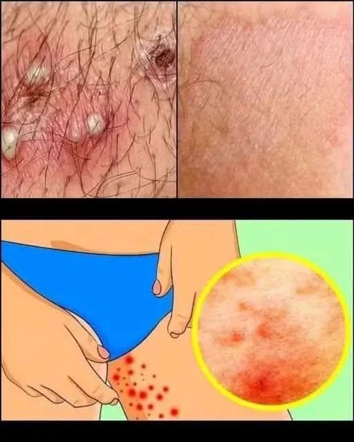 ⚠️ Papiloma Humano (VPH): el virus silencioso que muchos ignoran