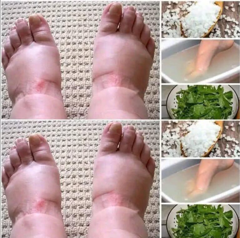 👣 Pies hinchados: lo que tu cuerpo realmente te está diciendo