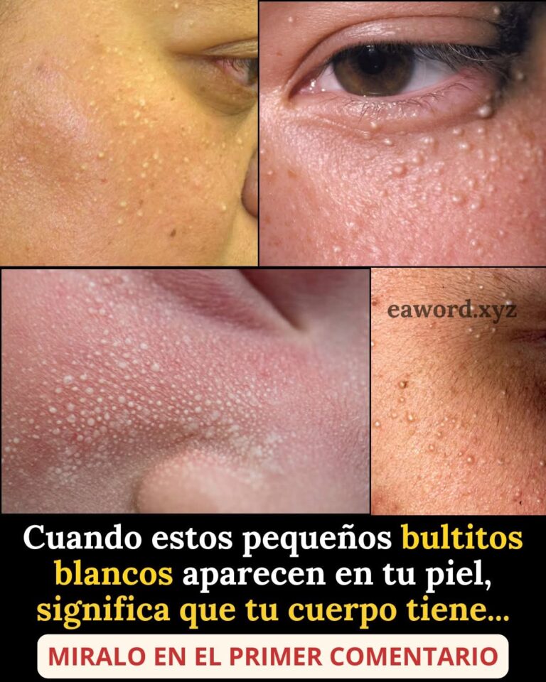 😳 ¿Te están saliendo granitos blancos en la cara? Esto es lo que realmente significa