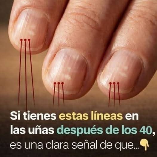 💅 ¿Tienes líneas verticales en las uñas? Esto es lo que realmente significa