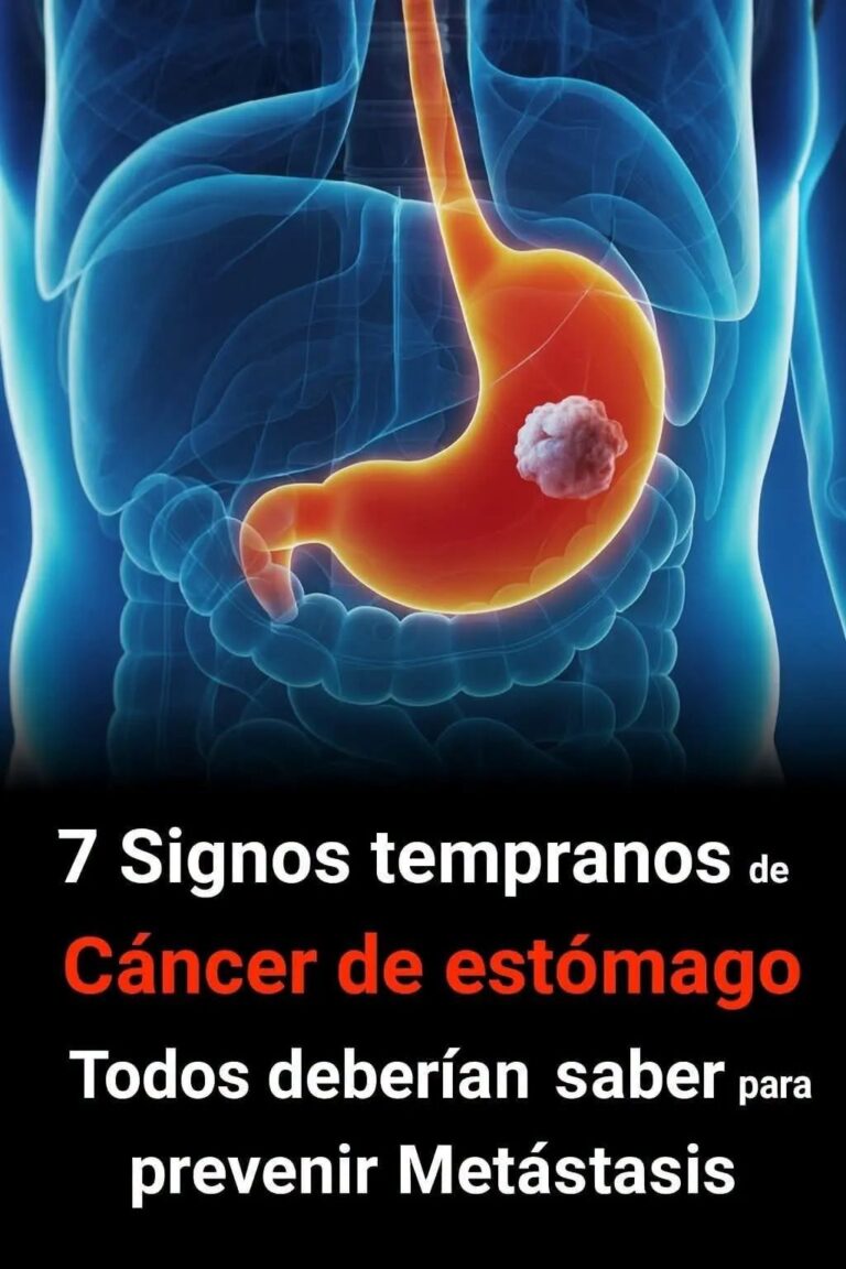 ⚠️ Las señales silenciosas del cáncer de estómago que muchas personas confunden con algo “normal”