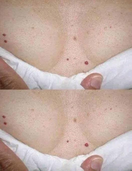 🚨 Puntos rojos en la piel: la señal silenciosa que muchos ignoran