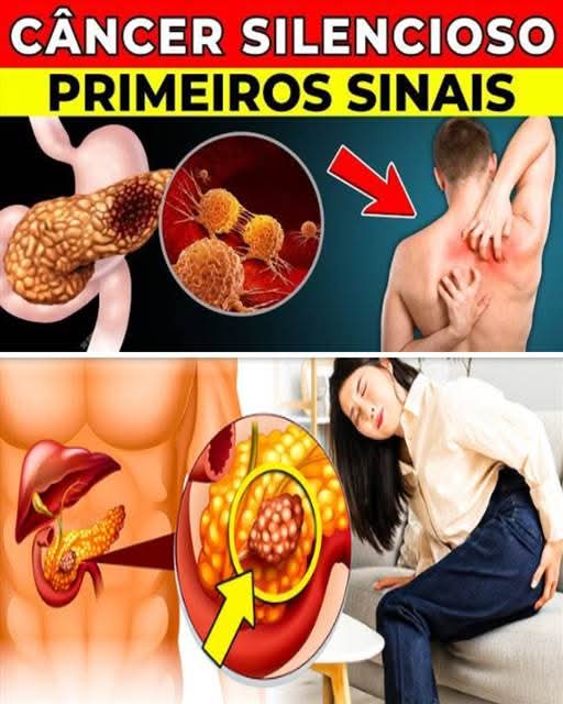 ⚠️ Las señales silenciosas del cáncer de páncreas que muchos confunden con algo “normal”