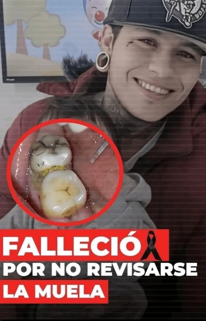 🚨 Dolor de muela: la señal que nunca debes ignorar