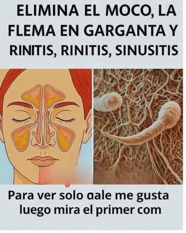 😷 Tenía flema y moco constante: lo que realmente puede ayudarte (sin caer en mitos)