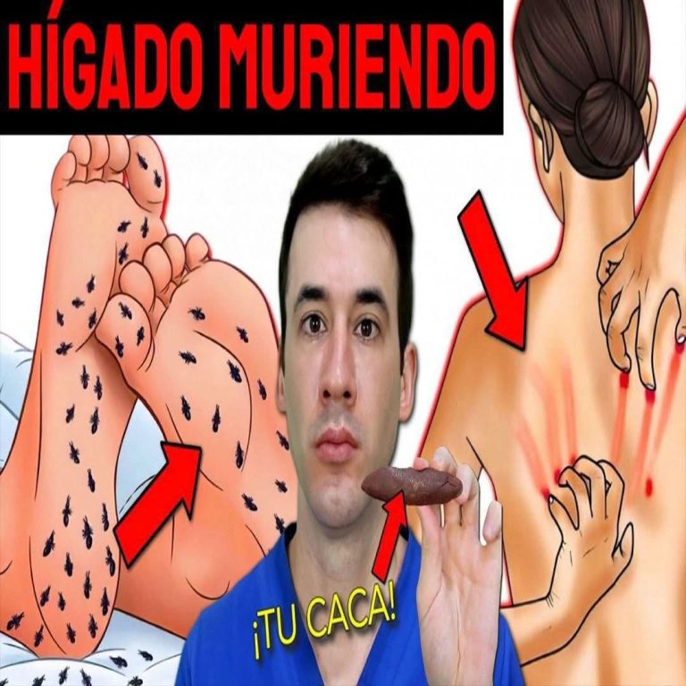 🚨 Señales de hígado graso que muchas personas ignoran