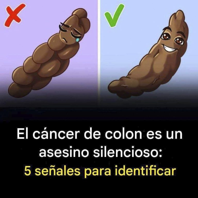 🚨 6 señales de cáncer de colon que nunca deberías ignorar