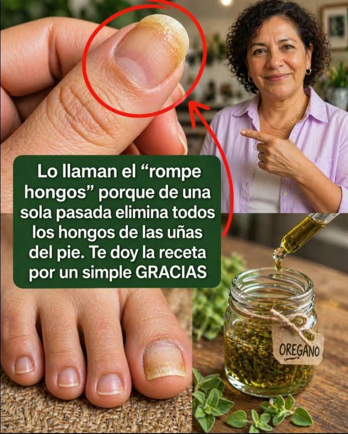 🚨 Hongos en las uñas: lo que realmente funciona (y lo que es mito)