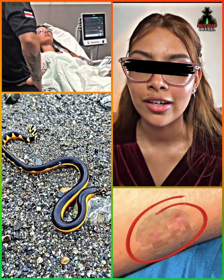 🚨 Mordida de serpiente marina: lo que realmente puede pasar (y lo que no te cuentan)