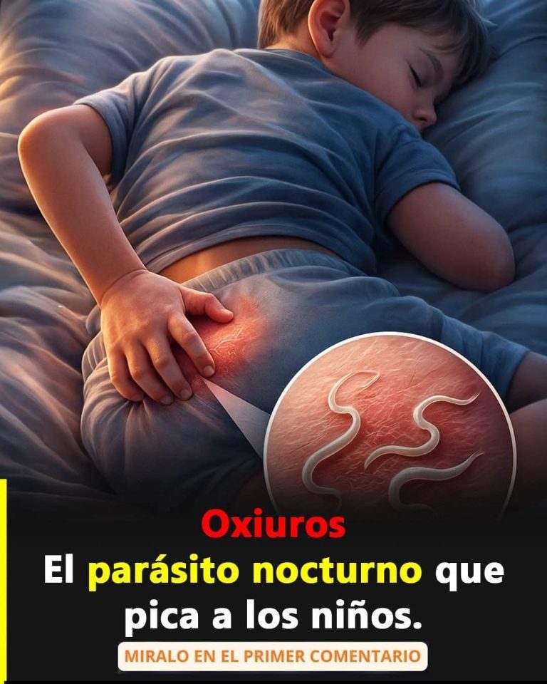 🚨 Oxiuros en niños: el parásito nocturno que muchos ignoran hasta que aparece la picazón
