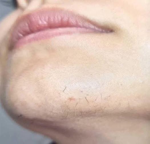 🚨 Si eres mujer y notas vello en el mentón… esto podría estar indicando tu cuerpo