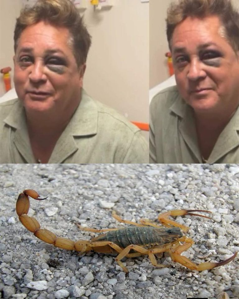 😱 Picadura de escorpión: lo que muchos no saben sobre este peligro silencioso