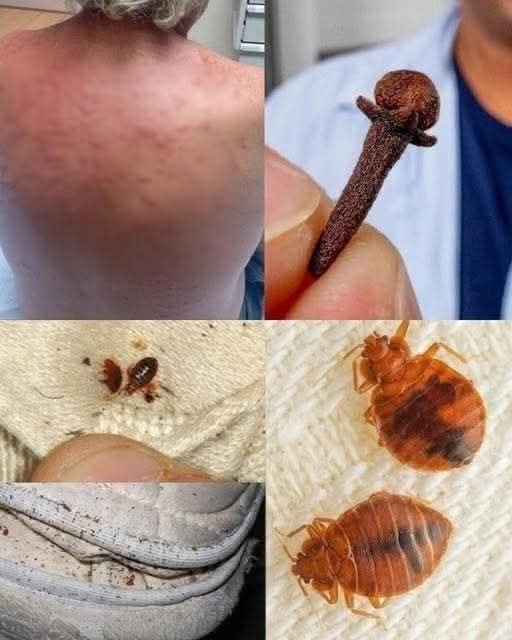 😨 Ácaros en tu cama: lo que nadie te dice y cómo eliminarlos de verdad