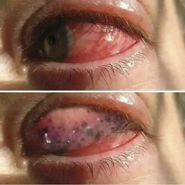 ⚠️ Estas son las consecuencias en tus ojos si duermes con esto sin saberlo