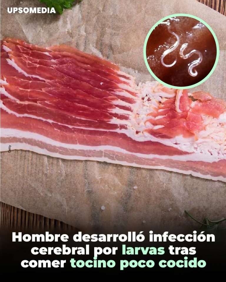 ⚠️ Tocino poco cocido: el riesgo oculto que muchos ignoran
