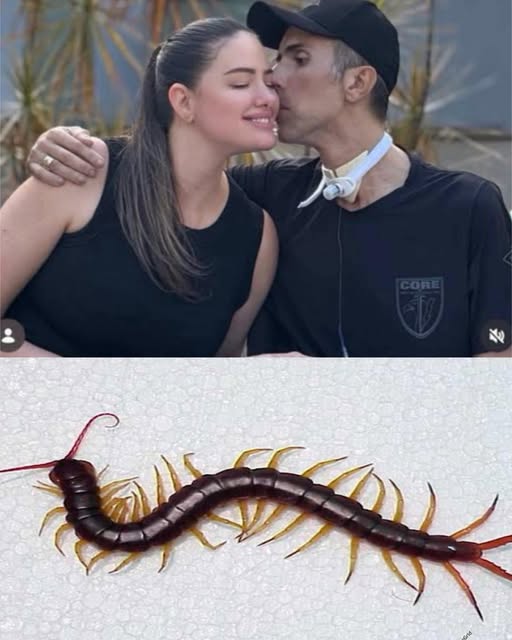🚨 posible causa de muerte relacionada con un extraño ciempiés