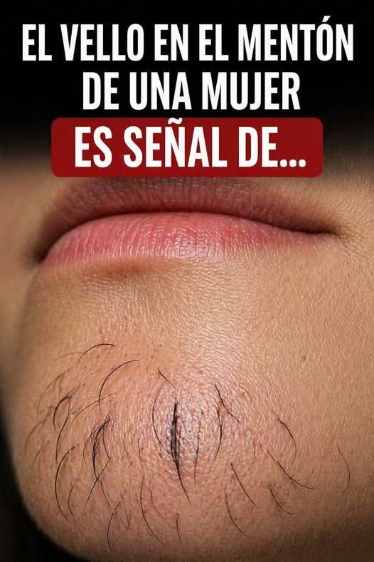 ⚠️ ¿Te ha salido vello en el mentón? Esto es lo que podría significar