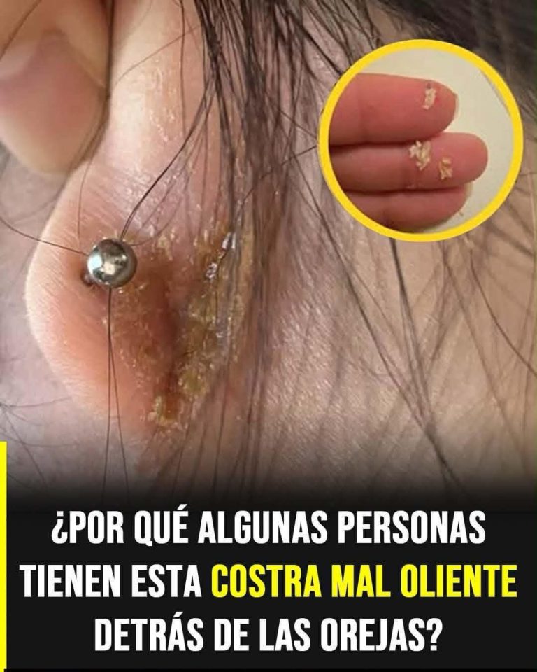 ⚠️ Costras detrás de las orejas: lo que tu cuerpo podría estar intentando decirte