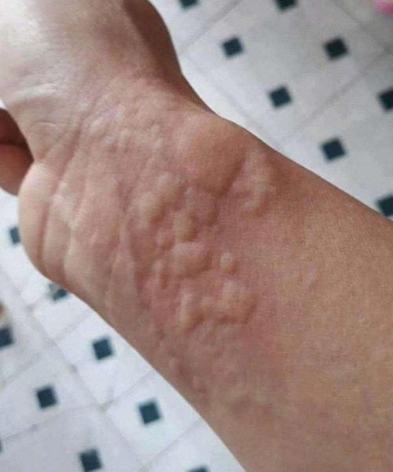🚨 Estas son las consecuencias de dormir con esto en la piel (y casi nadie lo sabe)