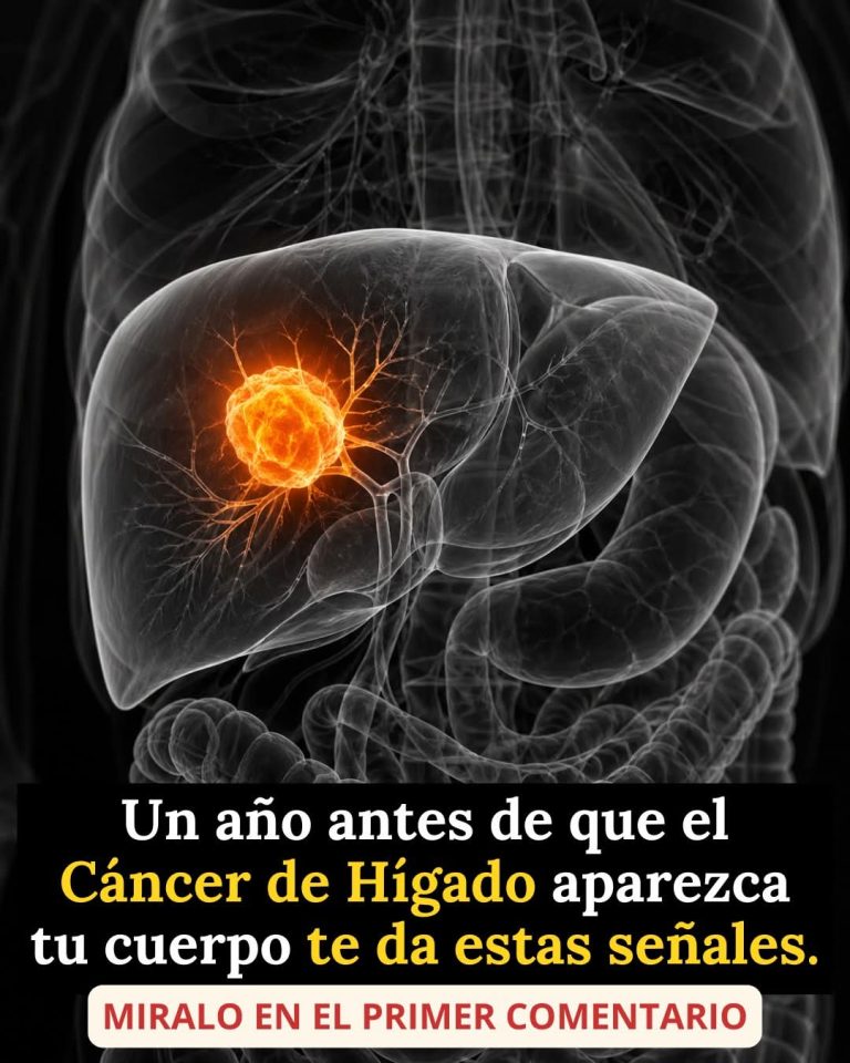 ⚠️ Estas señales podrían aparecer antes del cáncer de hígado… y muchos las ignoran