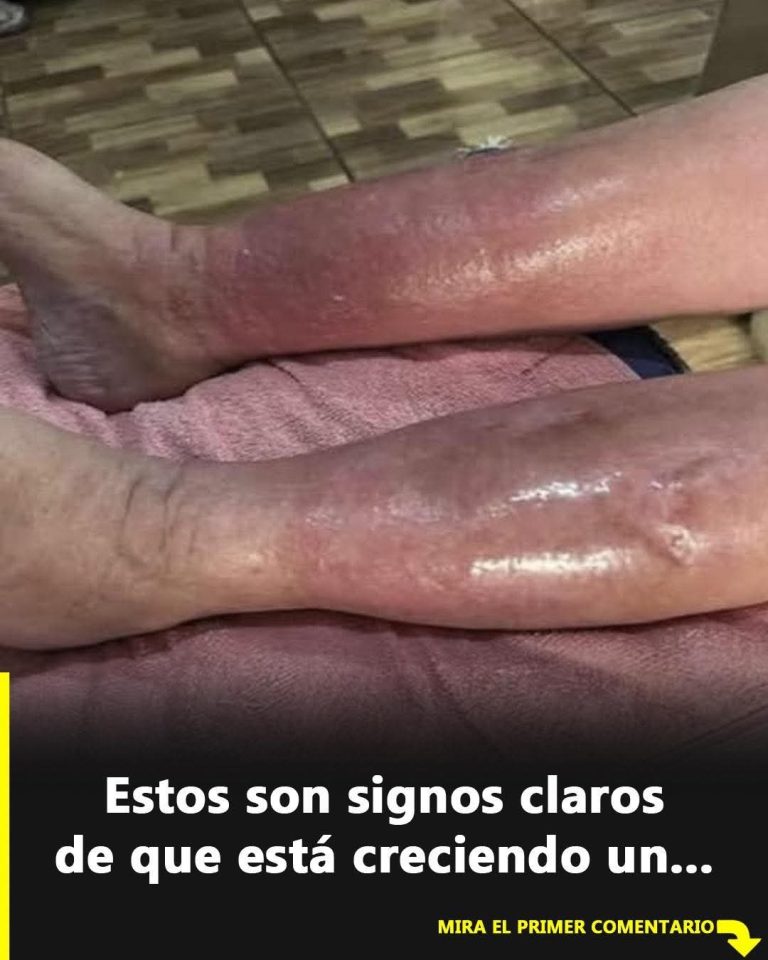 La peligrosa afección silenciosa que muchas personas confunden con simple cansancio en las piernas