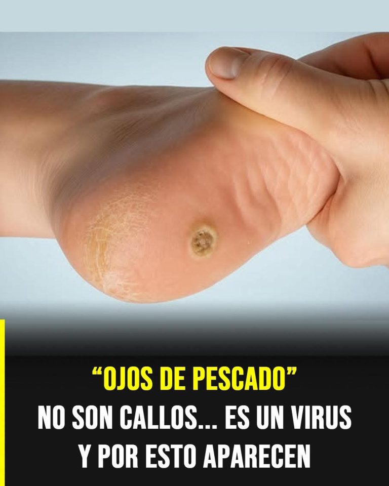 La lesión en los pies que millones confunden con un simple callo y en realidad puede ser causada por un virus