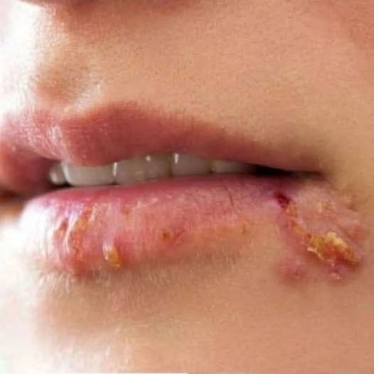 ⚠️ Si eres mujer, estas señales en los labios podrían estar advirtiendo algo importante sobre tu salud