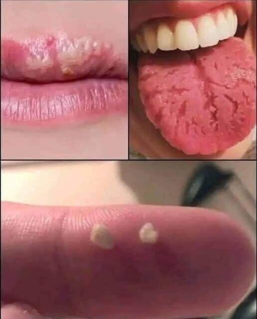 ⚠️ Estas señales en tu boca podrían estar indicando un problema de salud que muchas personas ignoran