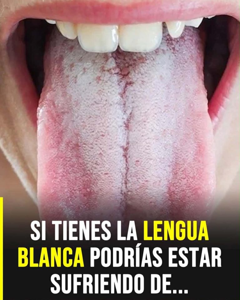 Si tienes la lengua blanca, tu cuerpo podría estar intentando decirte algo importante