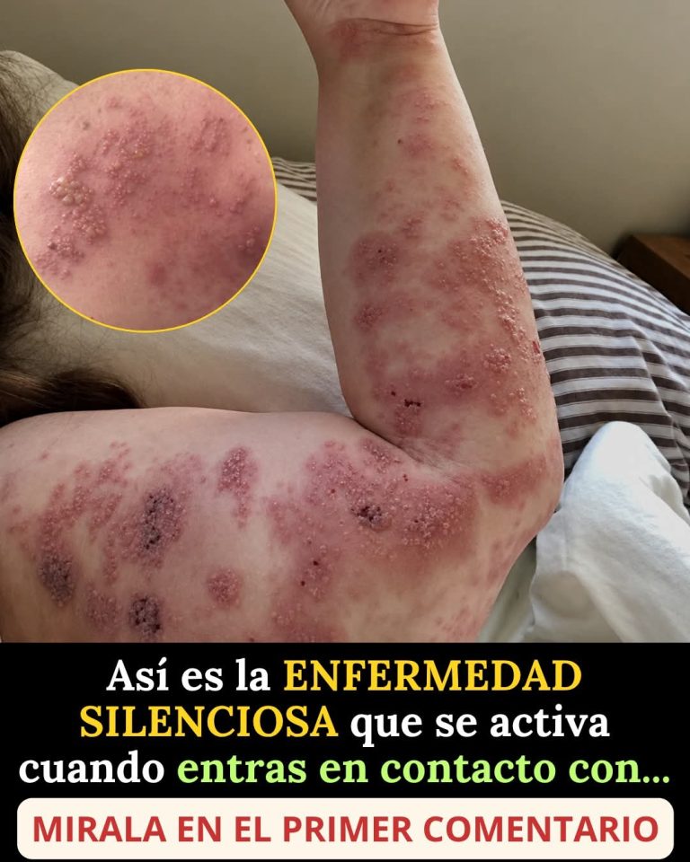La enfermedad silenciosa que puede activarse después de ciertos contactos y señales que muchos ignoran
